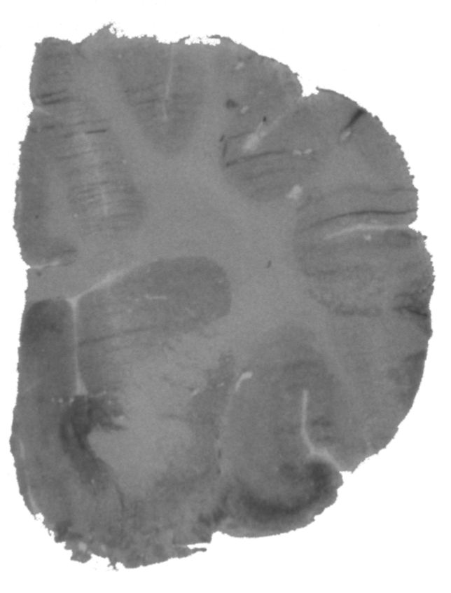 Film autoradiograph: a gray blob with a few dark areas.