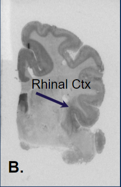 An autoradiogram of the coyote brain tissue with the rhinal ctx.