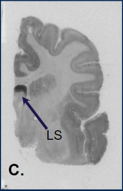An autoradiogram of a coyote brain tissue with the LS region. 