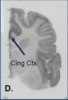 An autoradiograms of the coyote brain tissue with the LS Cing CTX. 