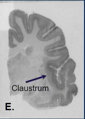 An autoradiograms of the coyote brain tissue with the Claustrum region. 
