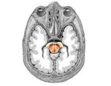 Diagram of the inside of a brain. Shows the location of the human substantia nigra at the center of the brain.