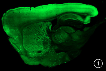 sagittal slice at 60 μm of a A2A-eNpHR modified mouse