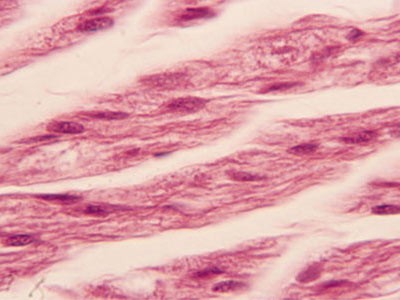 photograph of muscle tissue