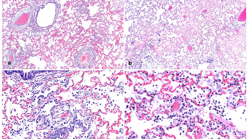 Microscopic images show lung tissue samples from mink infected with the SARS-CoV-2 virus.
