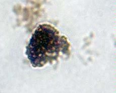 microfossils of the bacterium Bavlinella